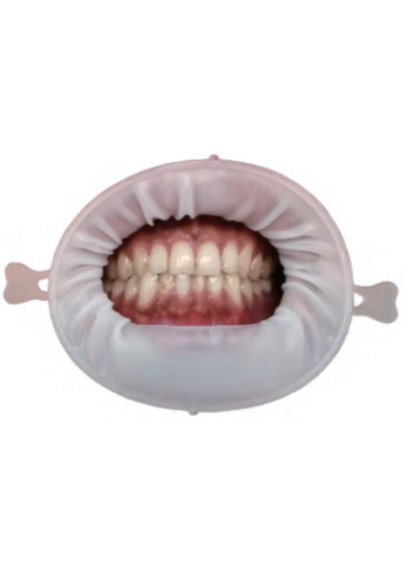 Mouth Lip Protector