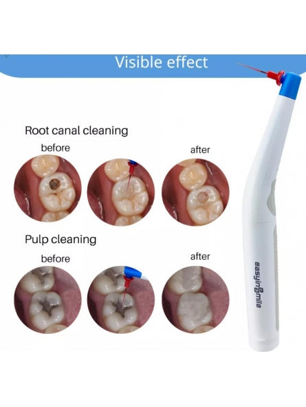 Easydo Activator Tips